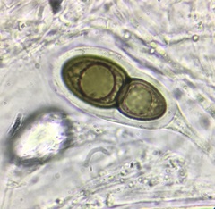 Splanchnonema ampullaceum