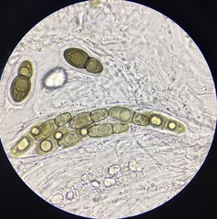 Splanchnonema ampullaceum