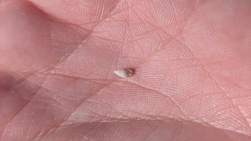 Parvanachis obesa observed 2026-03-20