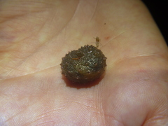 Pseudaneitea