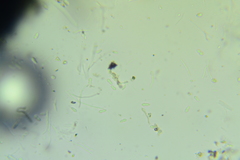 Anteaglonium parvulum