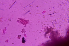 Eichleriella macrospora