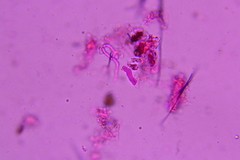 Eichleriella macrospora