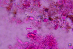 Eichleriella macrospora