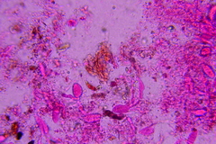 Eichleriella macrospora