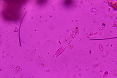 Eichleriella macrospora