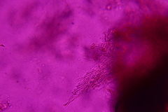 Eichleriella macrospora