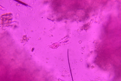 Eichleriella macrospora