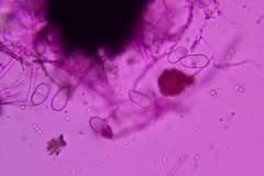 Trichothecium roseum