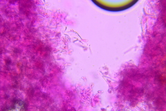 Exobasidium rostrupii