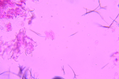 Exobasidium rostrupii