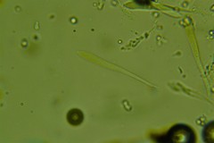 Hypoderma
