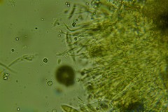 Hypoderma