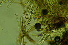 Trichopeziza mollissima
