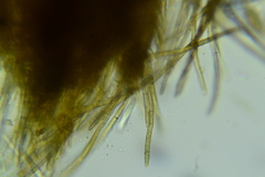 Trichopeziza mollissima