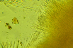 Phylloscypha labessiana