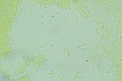 Cystolepiota seminuda