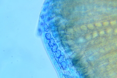 Scutellinia umbrorum