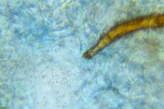 Scutellinia umbrorum