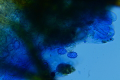 Scutellinia umbrorum