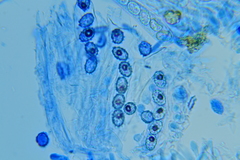 Scutellinia umbrorum