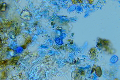 Scutellinia umbrorum