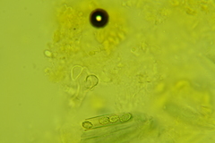 Peziza atrovinosa