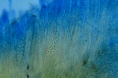 Peziza atrovinosa