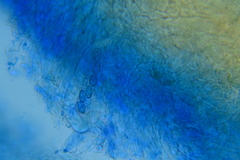 Peziza atrovinosa