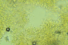 Hyphodontia arguta
