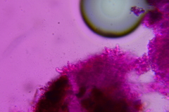 Lyomyces erastii