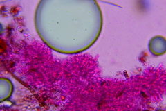 Lyomyces erastii