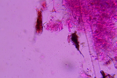 Lyomyces erastii