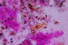 Lyomyces erastii