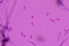 Hohenbuehelia cyphelliformis