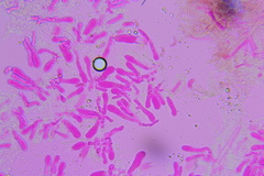 Hohenbuehelia cyphelliformis