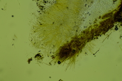 Trichopeziza