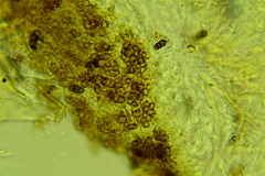 Trichopeziza