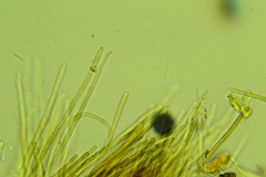 Trichopeziza
