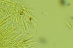 Trichopeziza