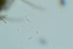 Trichopeziza