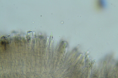 Trichopeziza