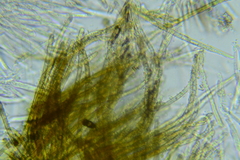 Trichopeziza