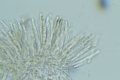 Trichopeziza