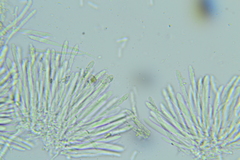 Trichopeziza