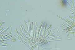 Trichopeziza