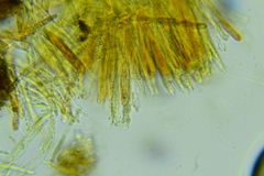 Trichopeziza