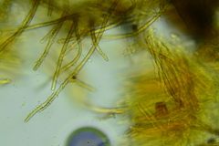 Trichopeziza