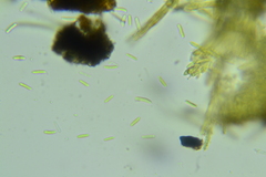 Trichopeziza