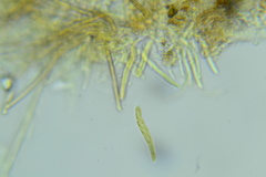 Trichopeziza
